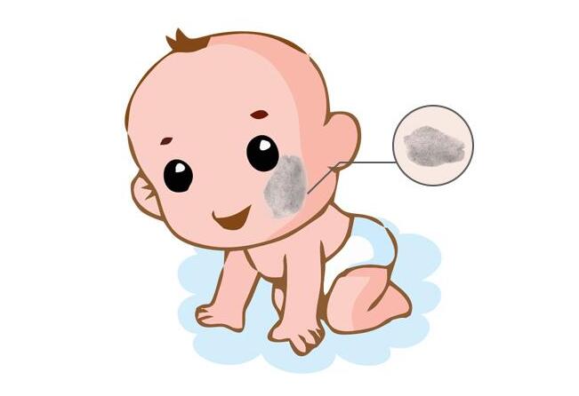 胎記是怎么來的