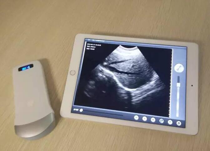 做b超是怎么做的