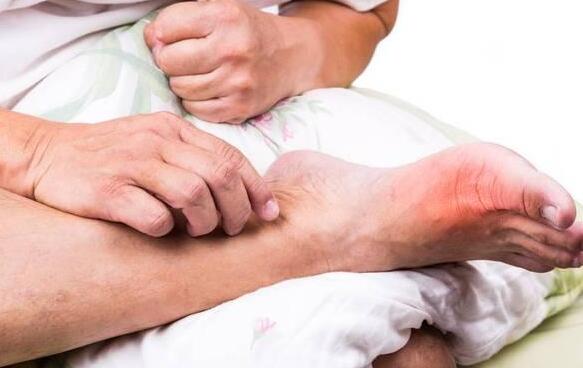 尿酸高怎么辦什么方法降最好