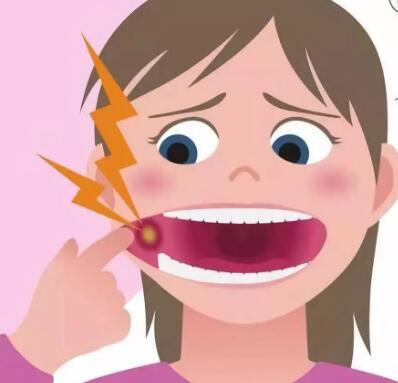 口腔潰瘍怎么辦最快最有效的方法