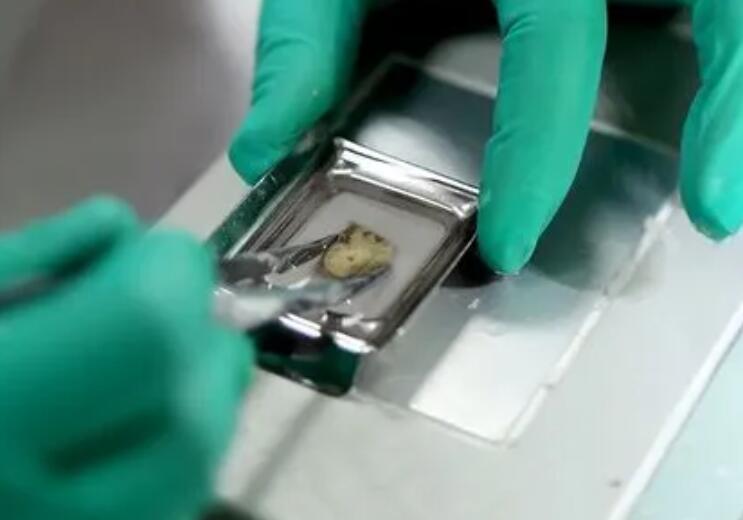 免疫組化檢查是什么意思？