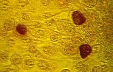 支原體查哪五項？